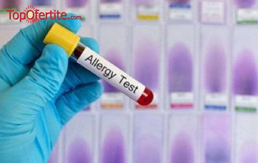 Комбиниран тест за алергии с изследване на 282 алергена от СМДЛ Кандиларов за 310 лв 